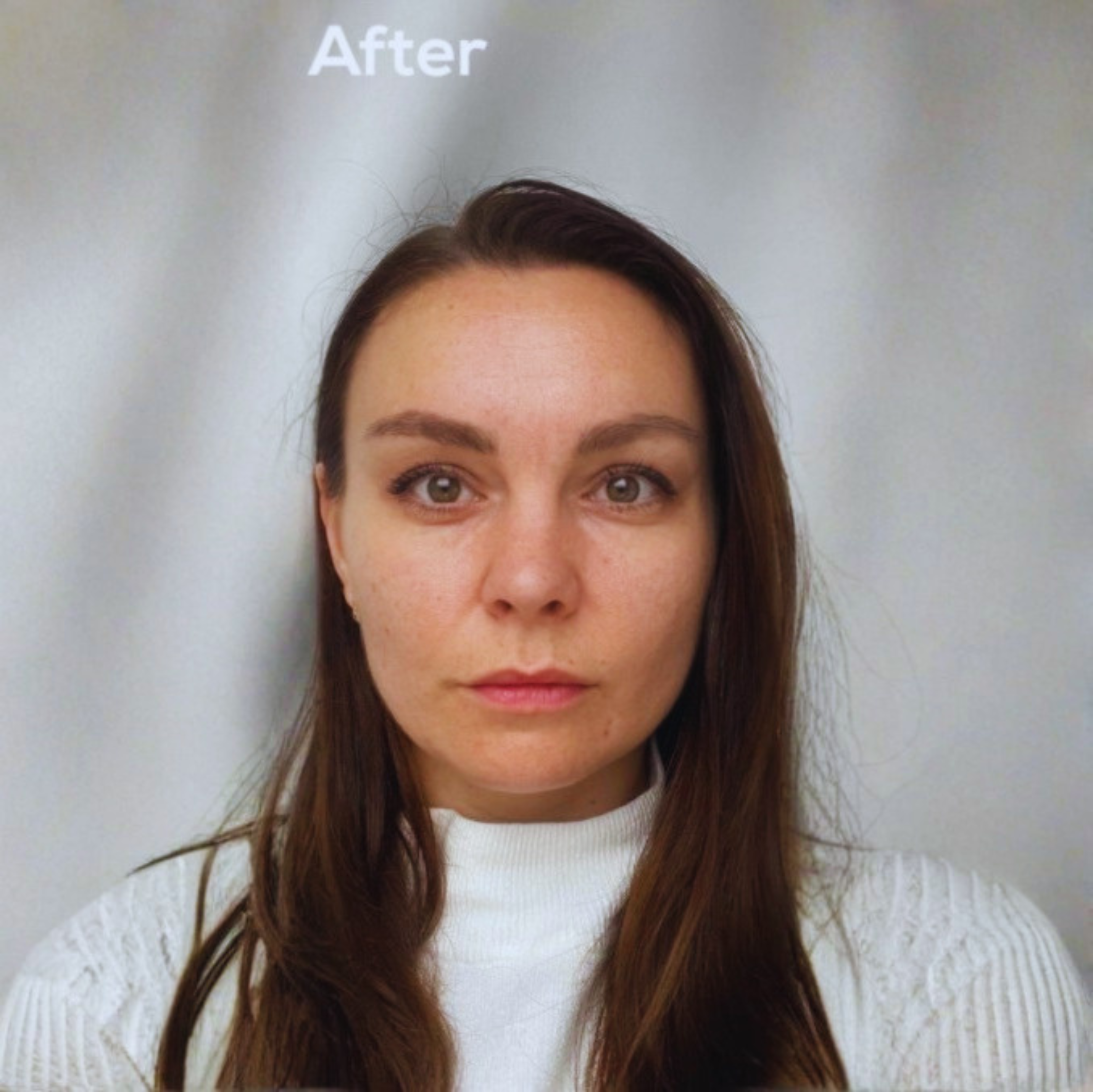 LBeauty YOUTH BOOSTER DrySerum after 7 days